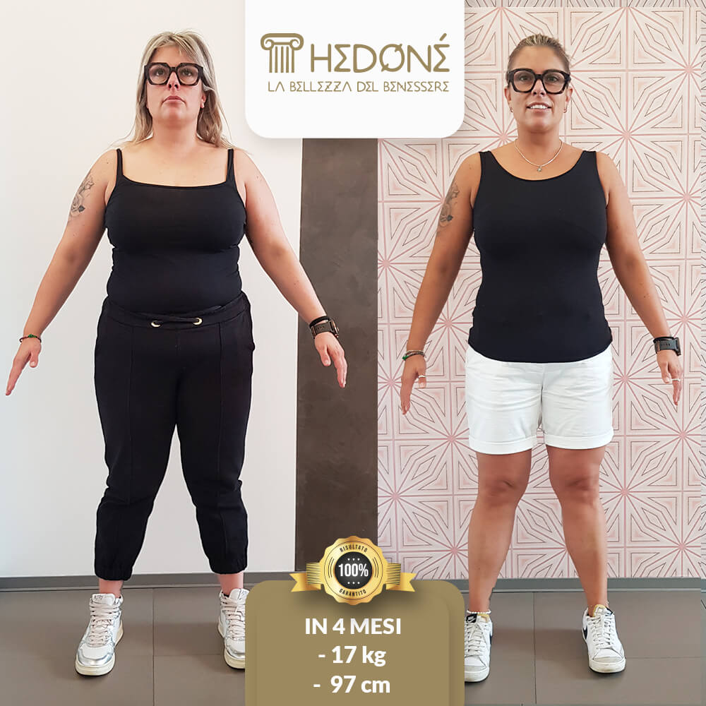 la storia di ilaria f s, prima e dopo