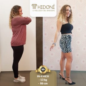 la storia di anna s, prima e dopo