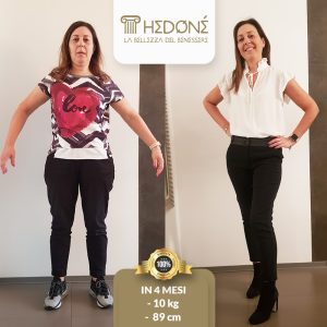 VALERIA-STORIA-VERA-come-dimagrire-bassano-vicenza-treviso-cittadella-castelfranco-padova